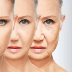 Age is Just a Number: Tackle Skin Problems at Every Stage and Age Like a Pro